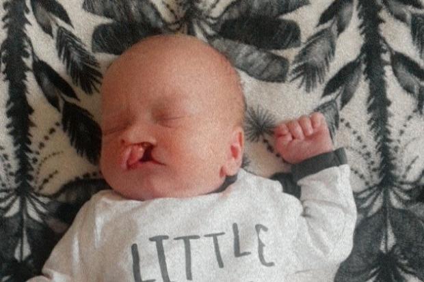 n Jackson John Thomas was born on April 29at 6.06am, weighing 7lb 12oz, with a unilateral cleft lip and palate. His proud parents Tamsin and Luke, and big sister Grace, from Carlisle, all hope to raise awareness of cleft by sharing Jackson’s